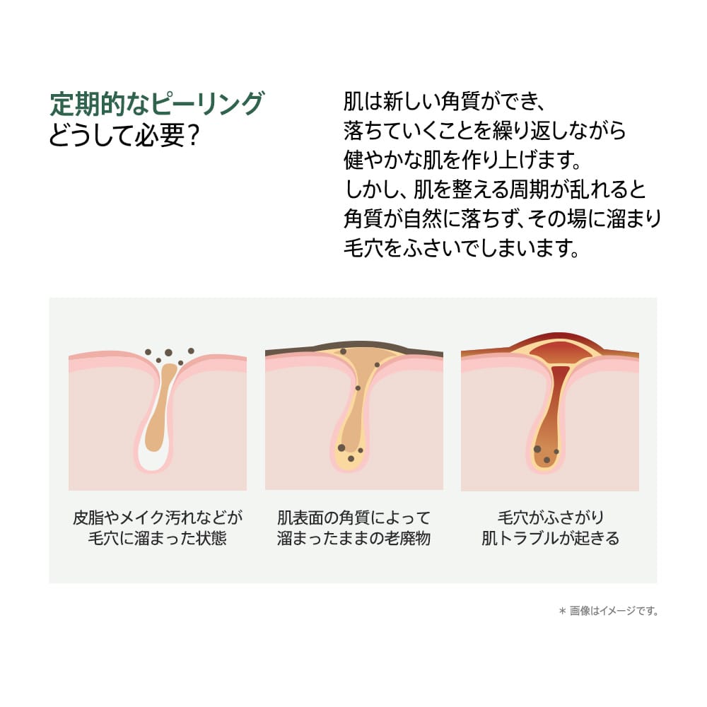 Anua クレンジング ドクダミLHAモイスチャー ピーリングジェル 120ml AA000191